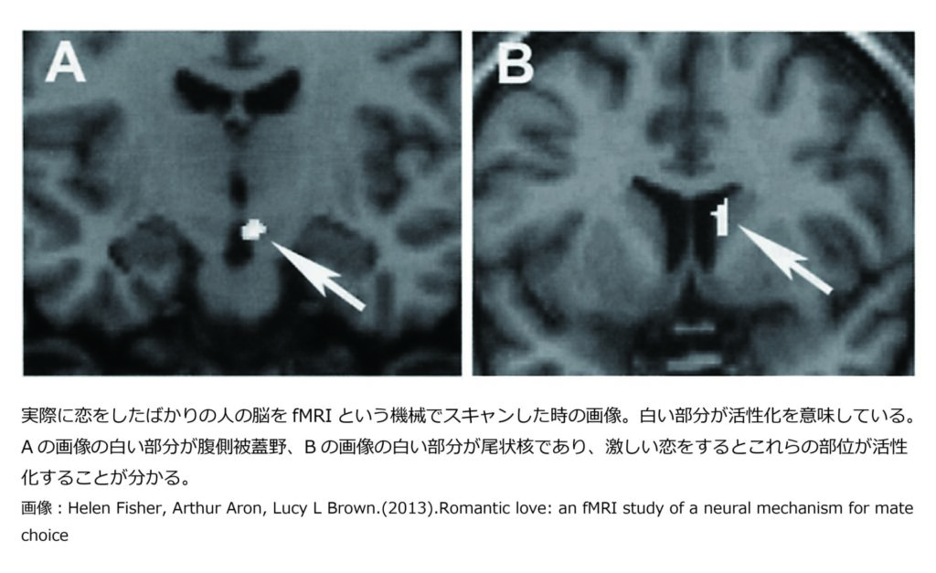 恋をしたばかりの人の脳をfMRIという機械でスキャンした時の画像