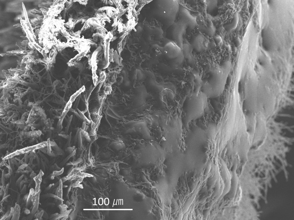 電子顕微鏡で見た虫こぶの断面